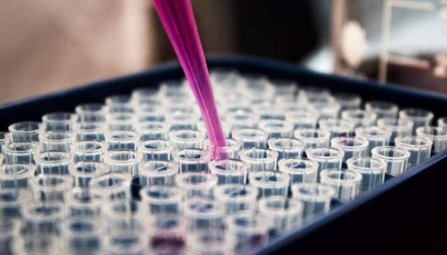 Развернутый анализ крови 