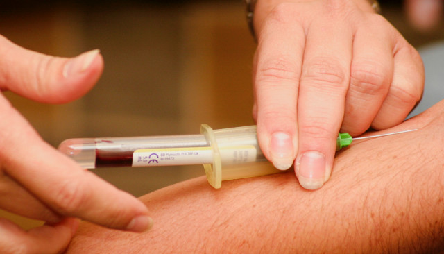 Підготовка до аналізів