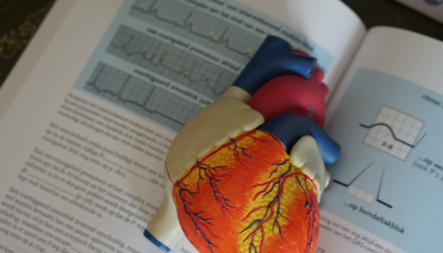 Эхокардиография